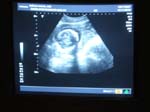 60_Ruth's_ultrasound
